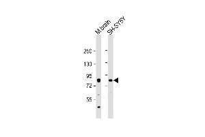 All lanes : Anti-PKC beta1/2 Antibody (Center) at 1:2000 dilution Lane 1: mouse brain lysate Lane 2: SH-SY5Y whole cell lysate Lysates/proteins at 20 μg per lane. (PKC beta1/2 (AA 303-334) antibody)