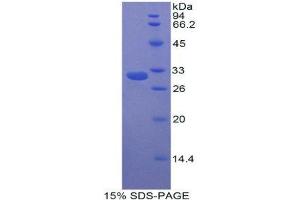 SDS-PAGE (SDS) image for Carboxypeptidase B2 (Plasma) (CPB2) (AA 164-417) protein (His tag) (ABIN1880045)