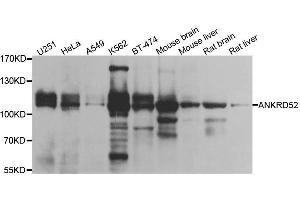Western blot analysis of extracts of various cell lines, using ANKRD52 antibody. (ANKRD52 antibody  (AA 450-660))