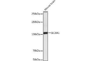Western blot analysis of extracts of Mouse brain , using SLC8 antibody (ABIN6132664, ABIN6148050, ABIN6148052 and ABIN6221228) at 1:5000 dilution. (SLC8A1 antibody  (AA 250-520))