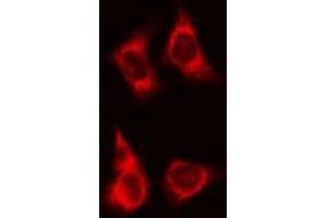ABIN6266780 staining HeLa cells by IF/ICC. (TNFRSF6B antibody)