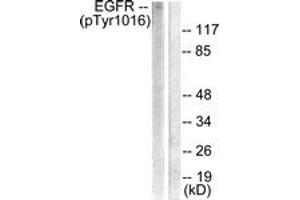 Western blot analysis of extracts from HuvEc cells treated with Serum 20% 30', using EGFR (Phospho-Tyr1016) Antibody. (EGFR antibody  (pTyr1016))