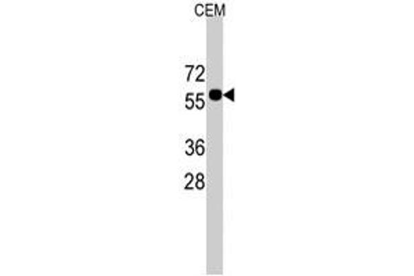 CNOT4 Antikörper  (C-Term)