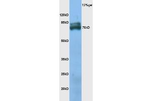 Mouse skeletal muscle lysate probed with Anti TXLNB Polyclonal Antibody, Unconjugated (ABIN1386717) at 1:200 overnight at 4 °C. (Taxilin beta antibody  (AA 331-430))