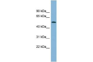 WB Suggested Anti-C2orf29 Antibody Titration: 0. (CNOT11 antibody  (N-Term))