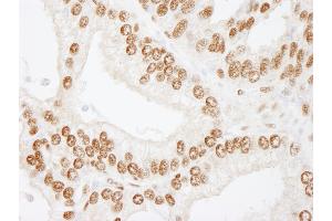 Immunohistochemistry (IHC) image for anti-cAMP Responsive Element Binding Protein 1 (CREB1) (AA 250-300) antibody (ABIN7448947) (CREB1 antibody  (AA 250-300))