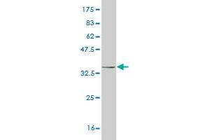 Western Blot detection against Immunogen (34. (HAND2 antibody  (AA 135-216))