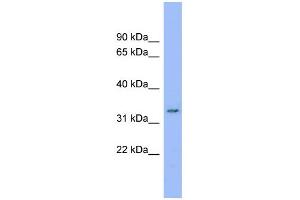 WB Suggested Anti-C20orf116 Antibody Titration:  0. (DDRGK1 antibody  (Middle Region))
