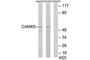Western blot analysis of extracts from HepG2/HuvEc cells, using CAMK5 Antibody. (CAMKV antibody  (AA 211-260))
