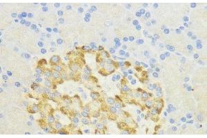 Immunohistochemistry of paraffin-embedded Rat pancreatic islet using SURF4 Polyclonal Antibody at dilution of 1:200 (40x lens). (Surfeit 4 antibody)