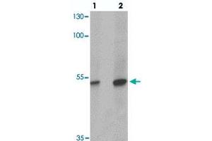 Western blot analysis of TFCP2L1 in human colon tissue with TFCP2L1 polyclonal antibody  at (1) 1 and (2) 2 ug/mL.