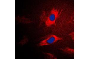 Immunofluorescent analysis of IARS2 staining in Jurkat cells. (IARS2 antibody  (N-Term))