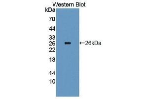 Western Blotting (WB) image for anti-Interleukin 4 Receptor (IL4R) antibody (Biotin) (ABIN1175405) (IL4 Receptor antibody  (Biotin))