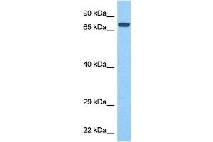 Host:  Rabbit  Target Name:  PTPRN  Sample Tissue:  Human Liver Tumor  Antibody Dilution:  1ug/ml (PTPRN antibody  (Middle Region))