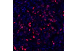 Immunofluorescence (IF) image for anti-Antigen Identified By Monoclonal Antibody Ki-67 (MKI67) (AA 1200-1250) antibody (ABIN7449552) (Recombinant Ki-67 antibody  (AA 1200-1250))