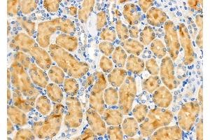 ABIN6263298 and ABIN6266594 at 1/100 staining Rat kidney tissue by IHC-P.