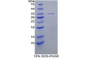 SDS-PAGE (SDS) image for Eukaryotic Translation Initiation Factor 6 (EIF6) (AA 622-848) protein (His tag) (ABIN2124751)