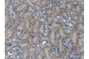 DAB staining on IHC-P; Samples: Mouse Kidney Tissue (EPRS antibody  (AA 1007-1512))