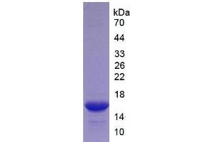 Image no. 1 for Tumor Necrosis Factor Receptor Superfamily, Member 9 (TNFRSF9) (AA 40-153) (Active) protein (His tag) (ABIN6239777) (CD137 Protein (AA 40-153) (His tag))