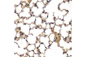 Immunohistochemistry of paraffin-embedded mouse lung using ASPSCR1 antibody at dilution of 1:100 (x400 lens).