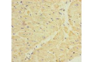Immunohistochemistry of paraffin-embedded human heart tissue using ABIN7149750 at dilution of 1:100 (Dermatopontin antibody  (AA 19-201))