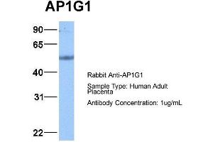 Host: Rabbit Target Name: AP1G1 Sample Type: Human Adult Placenta Antibody Dilution: 1. (gamma 1 Adaptin antibody  (C-Term))