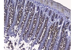 IHC analysis of Cytokeratin 19 using anti-Cytokeratin 19 antibody (ABIN3043288). (Cytokeratin 19 antibody  (C-Term))