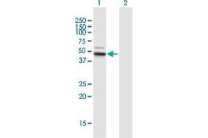 Western Blot analysis of ALDH3B1 expression in transfected 293T cell line by ALDH3B1 MaxPab polyclonal antibody. (ALDH3B1 antibody  (AA 1-431))
