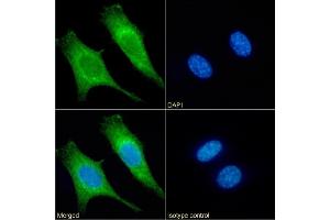Immunofluorescence staining of fixed NIH3T3 cells with anti-cytochrome c antibody 3. (Recombinant Cytochrome C antibody)