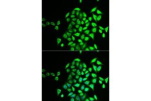 Immunofluorescence analysis of U2OS cells using NAPG antibody (ABIN5973832). (NAPG antibody)