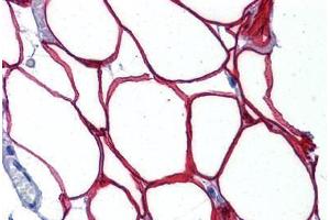 Human Adipocytes: Formalin-Fixed, Paraffin-Embedded (FFPE) (RNF25 antibody  (AA 377-439))