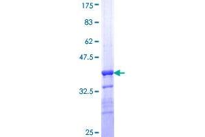 Transglutaminase 5 Protein (TGM5) (AA 511-610) (GST tag)