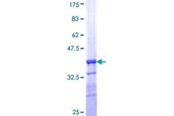 Transglutaminase 5 Protein (TGM5) (AA 511-610) (GST tag)