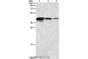 Western blot analysis of Human endometrial carcinoma tissue, A172 and U937 cell, using TWF2 Polyclonal Antibody at dilution of 1:800 (TWF2 antibody)