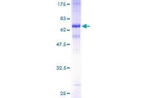 Image no. 1 for Melanoma Antigen Family A, 2 (MAGEA2) (AA 1-314) protein (GST tag) (ABIN1310037)