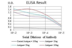 Black line: Control Antigen (100 ng), Purple line: Antigen(10 ng), Blue line: Antigen (50 ng), Red line: Antigen (100 ng), (Glucose-6-Phosphate Dehydrogenase antibody)