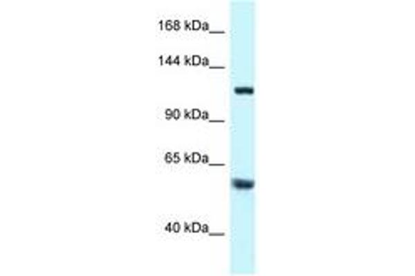 TBCD antibody  (AA 299-348)