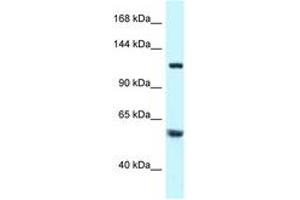 Image no. 1 for anti-Tubulin Folding Cofactor D (TBCD) (AA 299-348) antibody (ABIN6747499) (TBCD antibody  (AA 299-348))