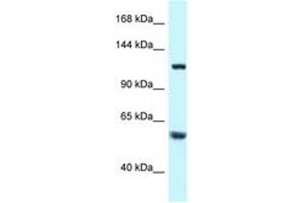 TBCD anticorps  (AA 299-348)