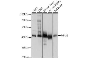Western blot analysis of extracts of various cell lines, using Pdha2 antibody (ABIN7269770) at 1:1000 dilution. (PDHA2 antibody  (AA 230-391))