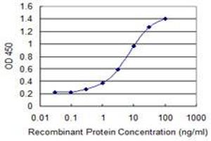 Detection limit for recombinant GST tagged ZNF192 is 0. (ZNF192 antibody  (AA 1-90))