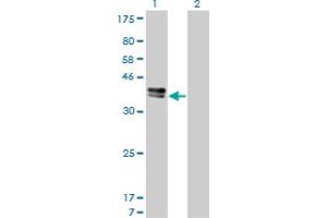 Western Blot analysis of ISL1 expression in transfected 293T cell line by ISL1 monoclonal antibody (M01), clone 1A3. (ISL1 antibody  (AA 63-159))