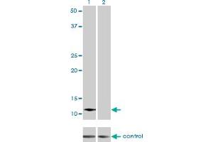 Western blot analysis of ACYP2 over-expressed 293 cell line, cotransfected with ACYP2 Validated Chimera RNAi (Lane 2) or non-transfected control (Lane 1).