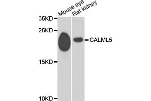 Western blot analysis of extracts of mouse eye and rat kidney, using CALML5 antibody. (CALML5 antibody)