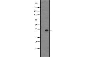 Western blot analysis of KLF14 expression in A431 whole cell lysate ,The lane on the left is treated with the antigen-specific peptide. (KLF14 antibody  (C-Term))