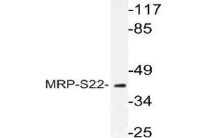 Western blot (WB) analysis of MRP-S22 antibody in extracts from COS cells.