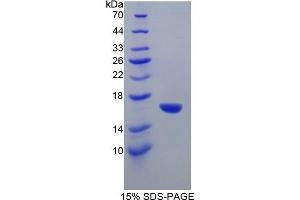 SDS-PAGE of Protein Standard from the Kit (Highly purified E. (GAD ELISA Kit)