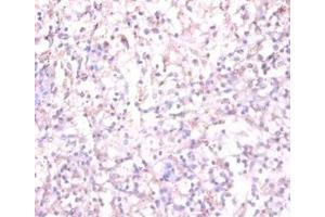Immunohistochemistry of paraffin-embedded human spleen tissue using ABIN7170878 at dilution of 1:100 (TACR1 antibody  (AA 1-29))
