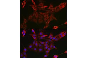 Immunofluorescence analysis of PC-12 cells using UBQLN4 Rabbit pAb (ABIN7271124) at dilution of 1:50 (40x lens).