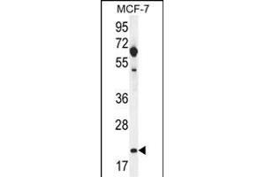 hCG_1646420 Antibody (Center) (ABIN656075 and ABIN2845422) western blot analysis in MCF-7 cell line lysates (35 μg/lane). (CLDN25 antibody  (AA 99-128))
